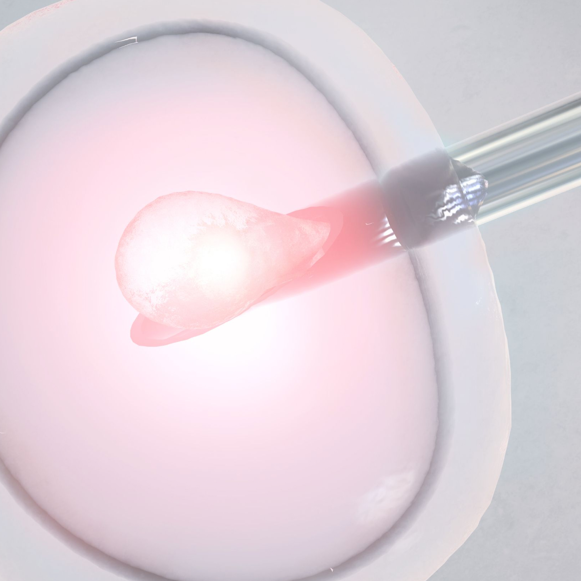 Knstliche Befruchtung  IVF | Prague Fertility Centre